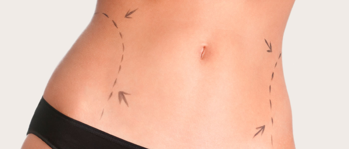 Introducing Liposuction Melbourne post thumbnail image